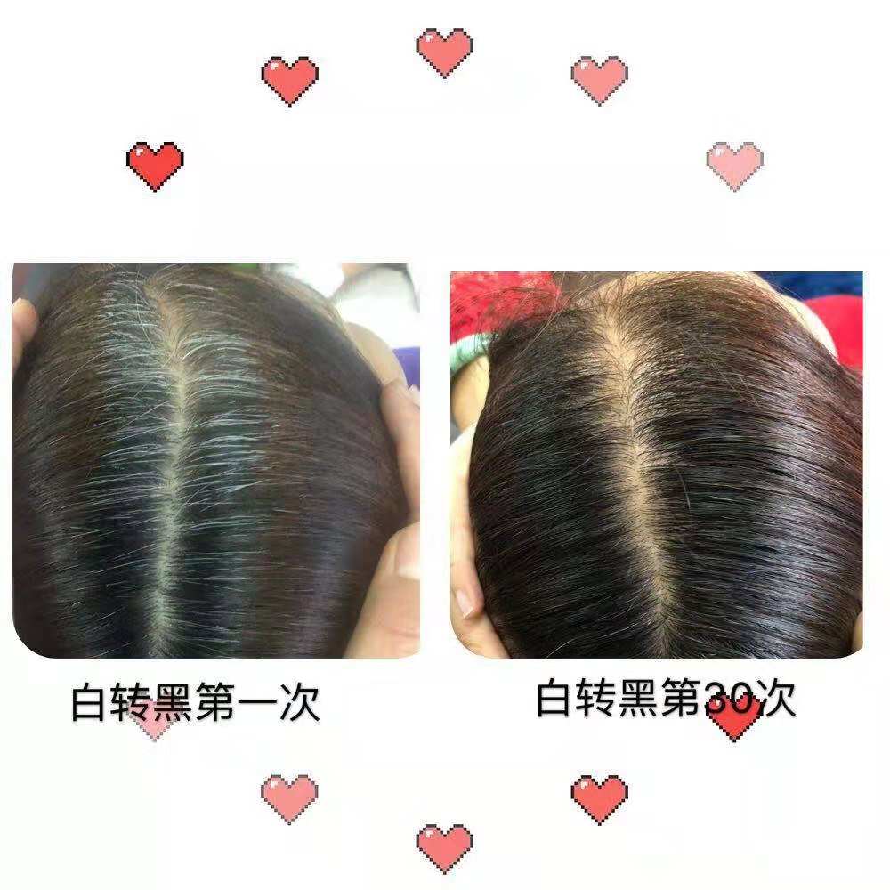 【贺彩客户鉴证】十年白发变黑发！她到底做了